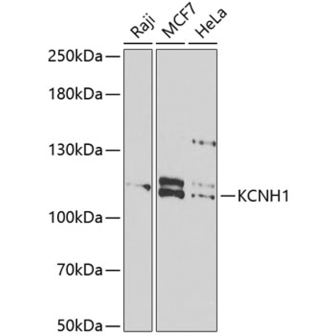 KCNH1 Rabbit Polyclonal Antibody