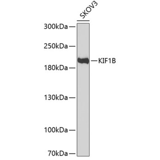 KIF1B Rabbit Polyclonal Antibody