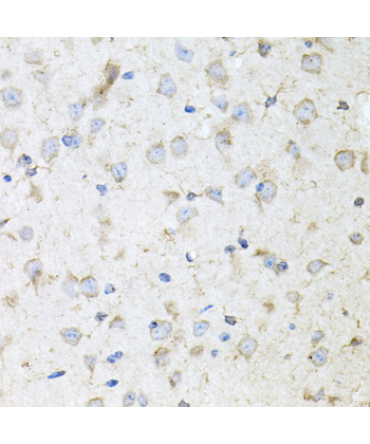 KLK11 Rabbit Polyclonal Antibody