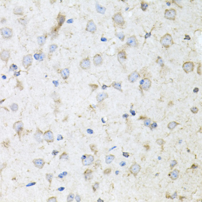 KLK11 Rabbit Polyclonal Antibody