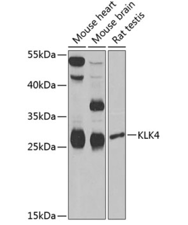 KLK4 Rabbit Polyclonal Antibody