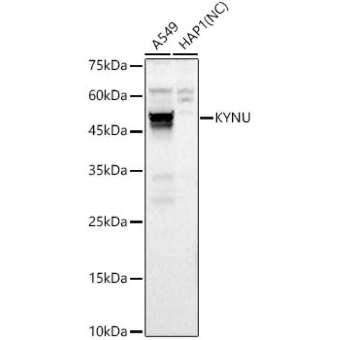 KYNU Rabbit Polyclonal Antibody