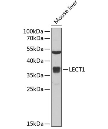 LECT1 Rabbit Polyclonal Antibody