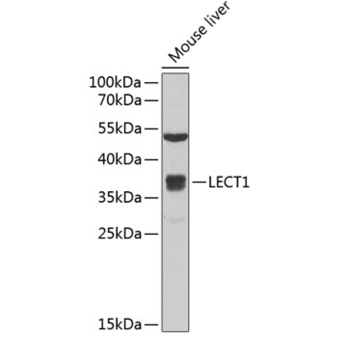 LECT1 Rabbit Polyclonal Antibody
