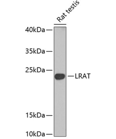LRAT Rabbit Polyclonal Antibody