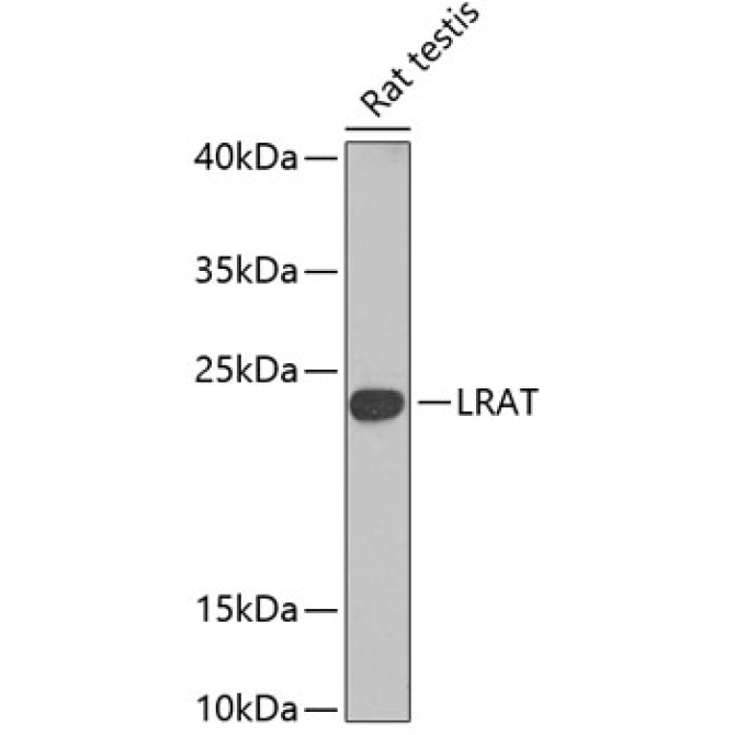 LRAT Rabbit Polyclonal Antibody