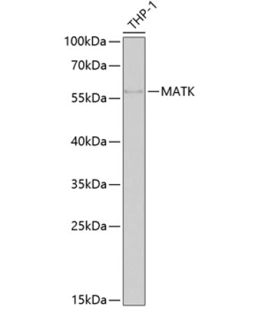 MATK Rabbit Polyclonal Antibody