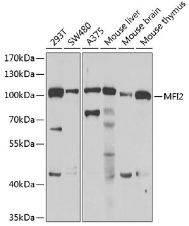 MFI2 Rabbit Polyclonal Antibody