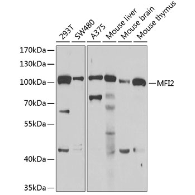 MFI2 Rabbit Polyclonal Antibody