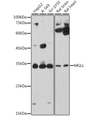 MGLL Rabbit Polyclonal Antibody
