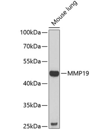 MMP19 Rabbit Polyclonal Antibody