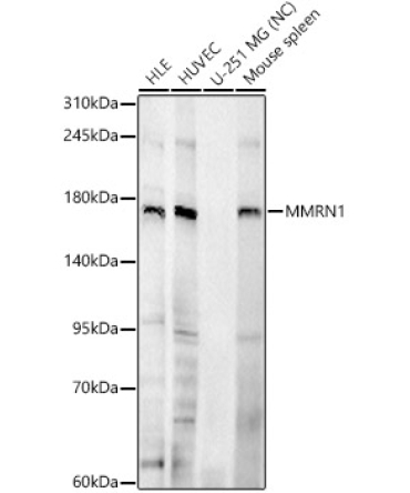 MMRN1 Rabbit Polyclonal Antibody