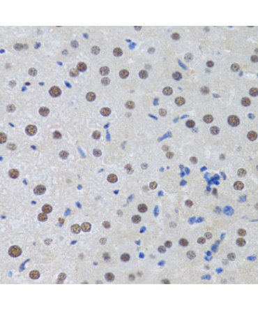MTA3 Rabbit Polyclonal Antibody