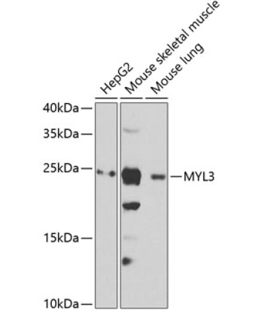 MYL3 Rabbit Polyclonal Antibody