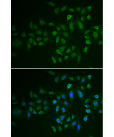 MYLK3 Rabbit Polyclonal Antibody