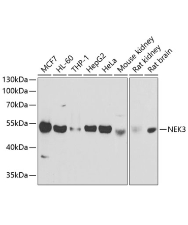 NEK3 Rabbit Polyclonal Antibody