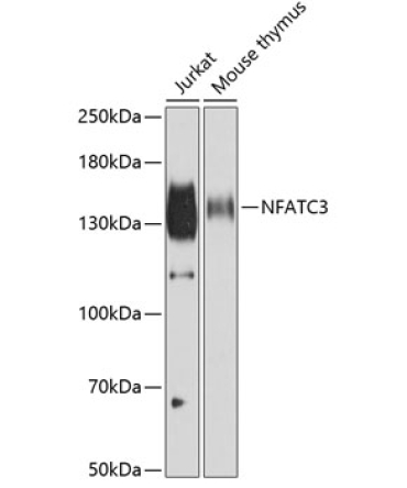 NFATC3 Rabbit Polyclonal Antibody