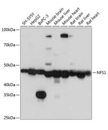 NFS1 Rabbit Polyclonal Antibody