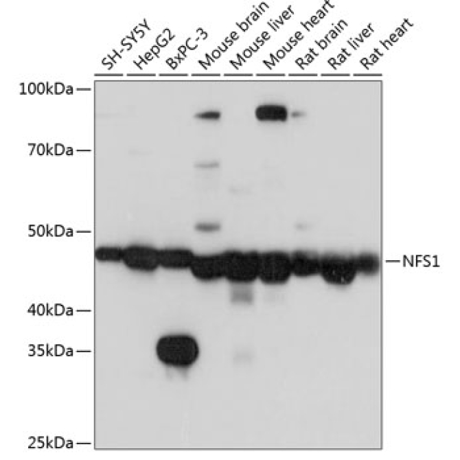 NFS1 Rabbit Polyclonal Antibody