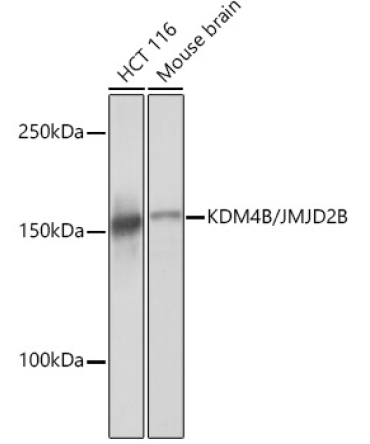 KDM4B/JMJD2B Rabbit Monoclonal Antibody
