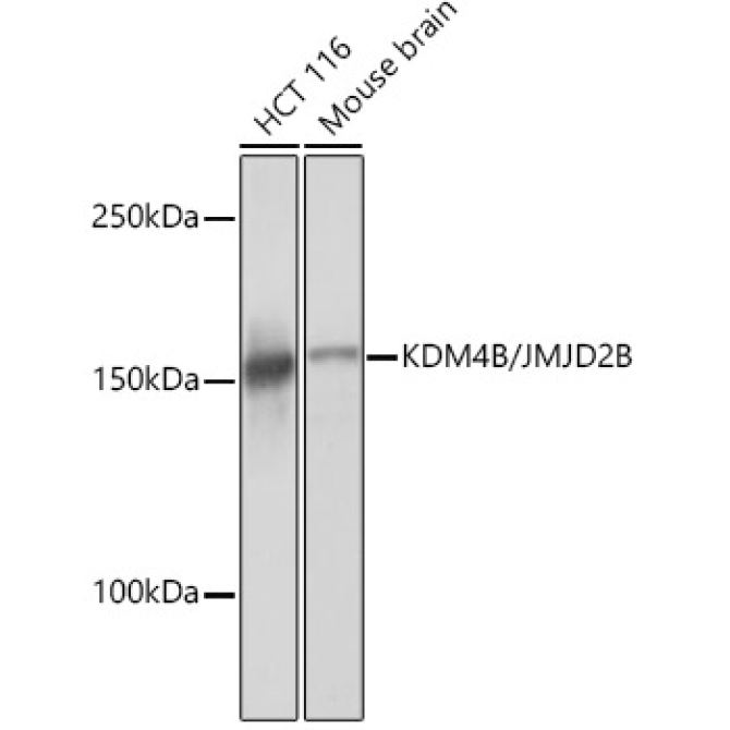 KDM4B/JMJD2B Rabbit Monoclonal Antibody