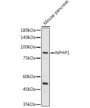 NPHP1 Rabbit Polyclonal Antibody