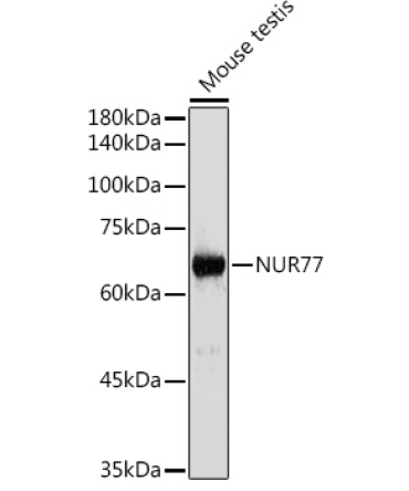 NUR77 Rabbit Polyclonal Antibody