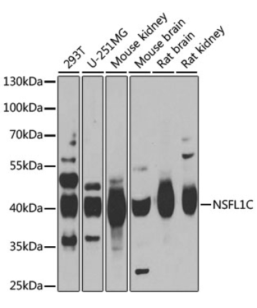 NSFL1C Rabbit Polyclonal Antibody