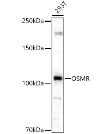 OSMR Rabbit Polyclonal Antibody