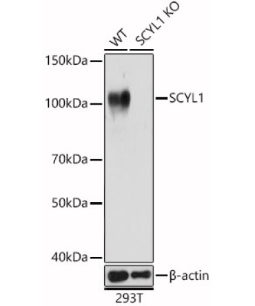 SCYL1 Rabbit Polyclonal Antibody [KO Validated]