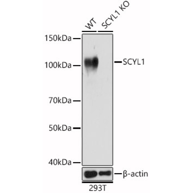 SCYL1 Rabbit Polyclonal Antibody [KO Validated]