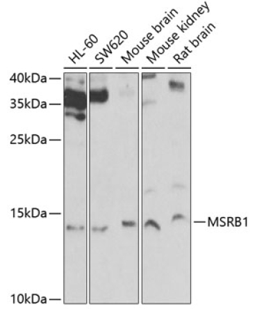MSRB1 Rabbit Polyclonal Antibody