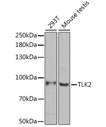 TLK2 Rabbit Polyclonal Antibody [KO Validated]