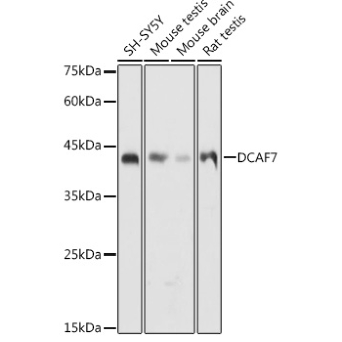DCAF7 Rabbit Polyclonal Antibody
