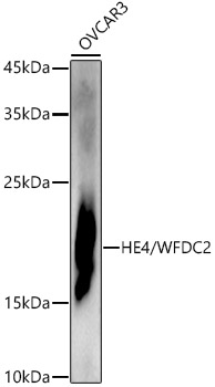 HE4/WFDC2 Rabbit Polyclonal Antibody