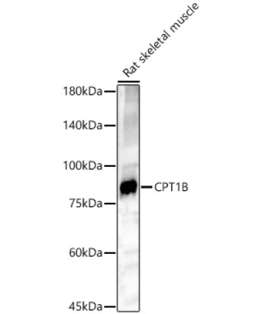 CPT1B Rabbit Polyclonal Antibody