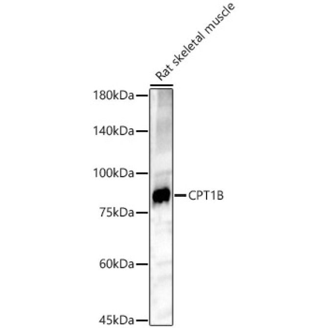 CPT1B Rabbit Polyclonal Antibody