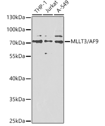 MLLT3/AF9 Rabbit Polyclonal Antibody