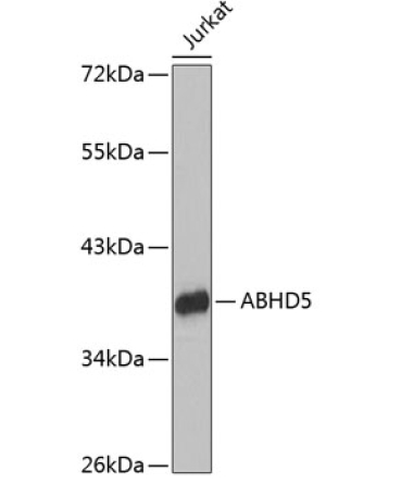 ABHD5 Rabbit Polyclonal Antibody