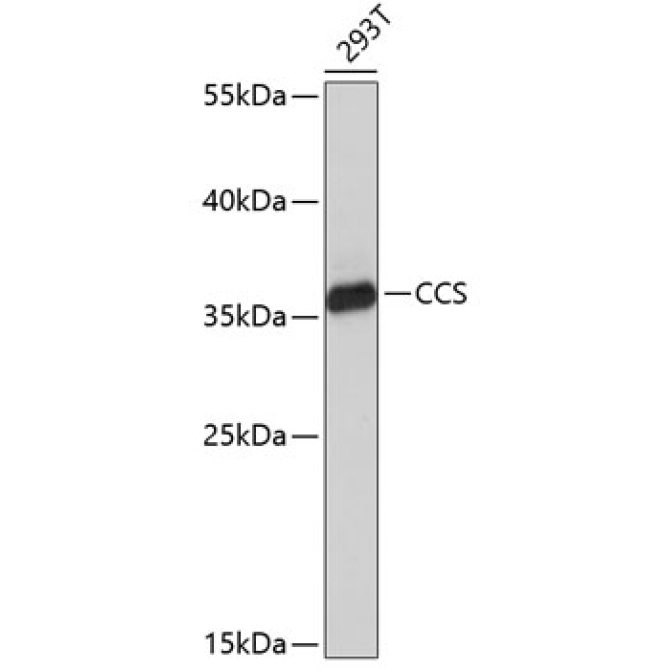 CCS Rabbit Polyclonal Antibody