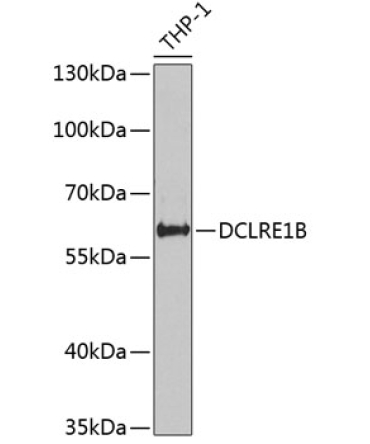 DCLRE1B Rabbit Polyclonal Antibody