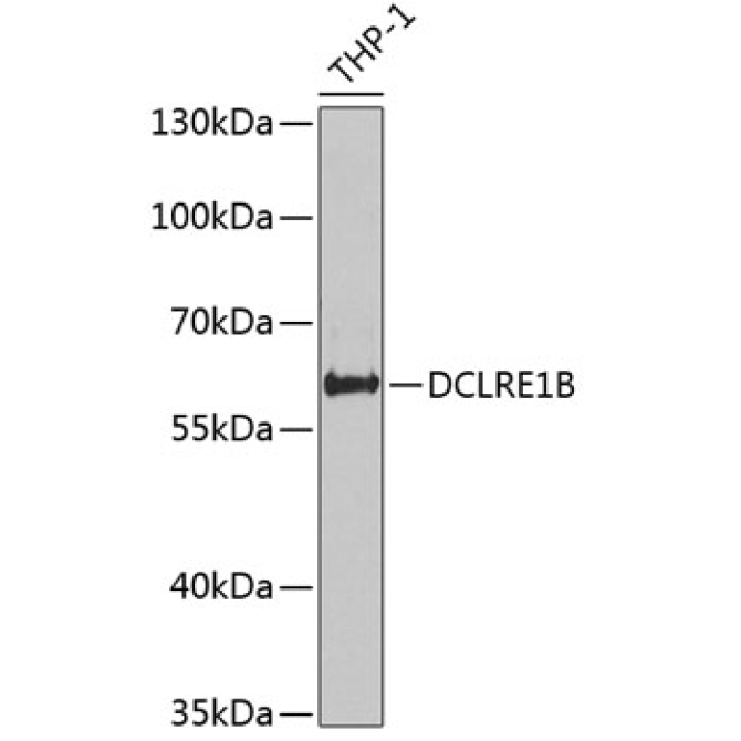 DCLRE1B Rabbit Polyclonal Antibody