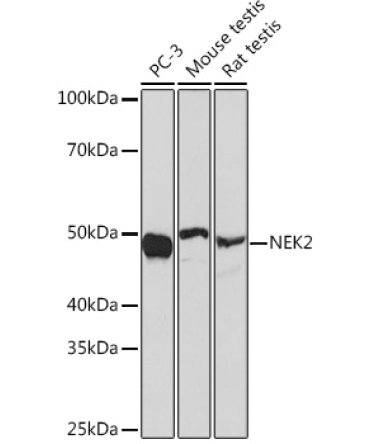 NEK2 Rabbit Monoclonal Antibody