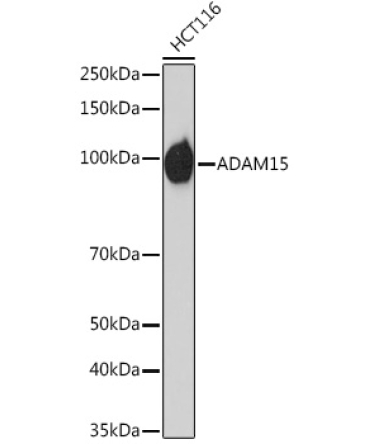 ADAM15 Rabbit Monoclonal Antibody
