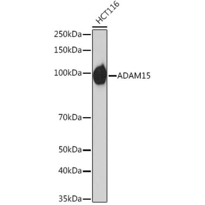 ADAM15 Rabbit Monoclonal Antibody