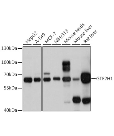 GTF2H1 Rabbit Polyclonal Antibody