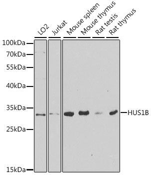 HUS1B Rabbit Polyclonal Antibody