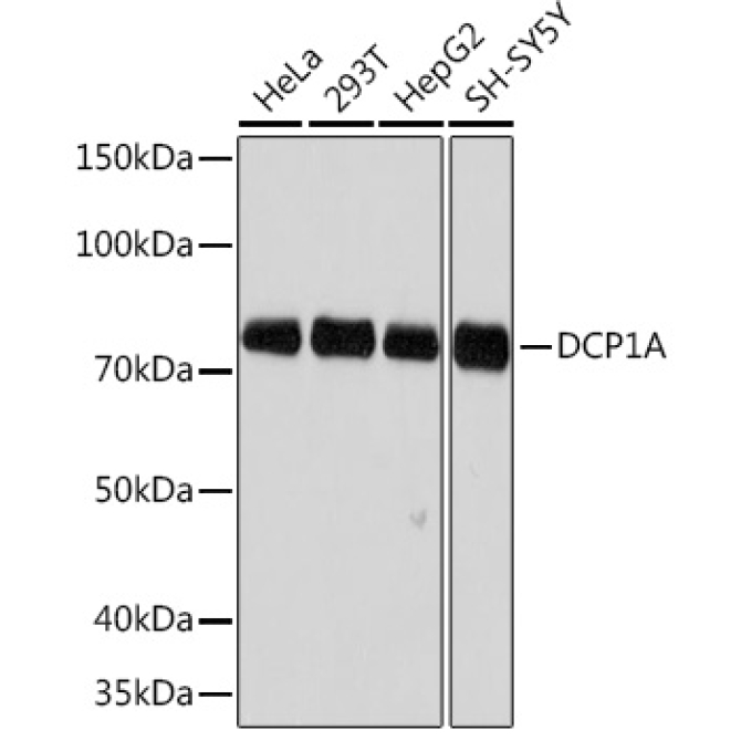 DCP1A Rabbit Monoclonal Antibody