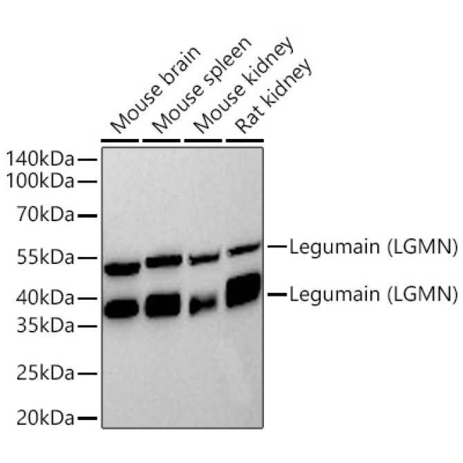 Legumain (LGMN) Rabbit Monoclonal Antibody