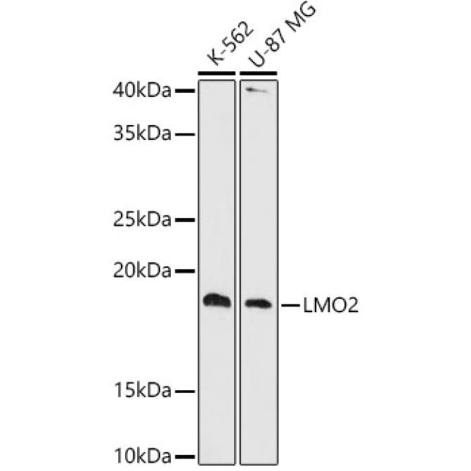 LMO2 Rabbit Monoclonal Antibody